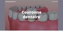 Couronne dentaire